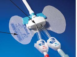 Statlock® Dialysis Catheter Stabilization Device